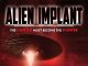 Alien Implant