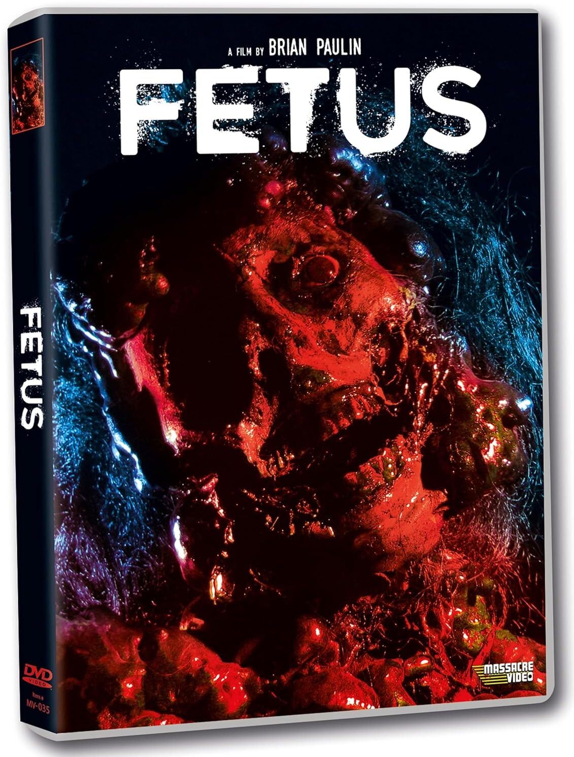 Fetus